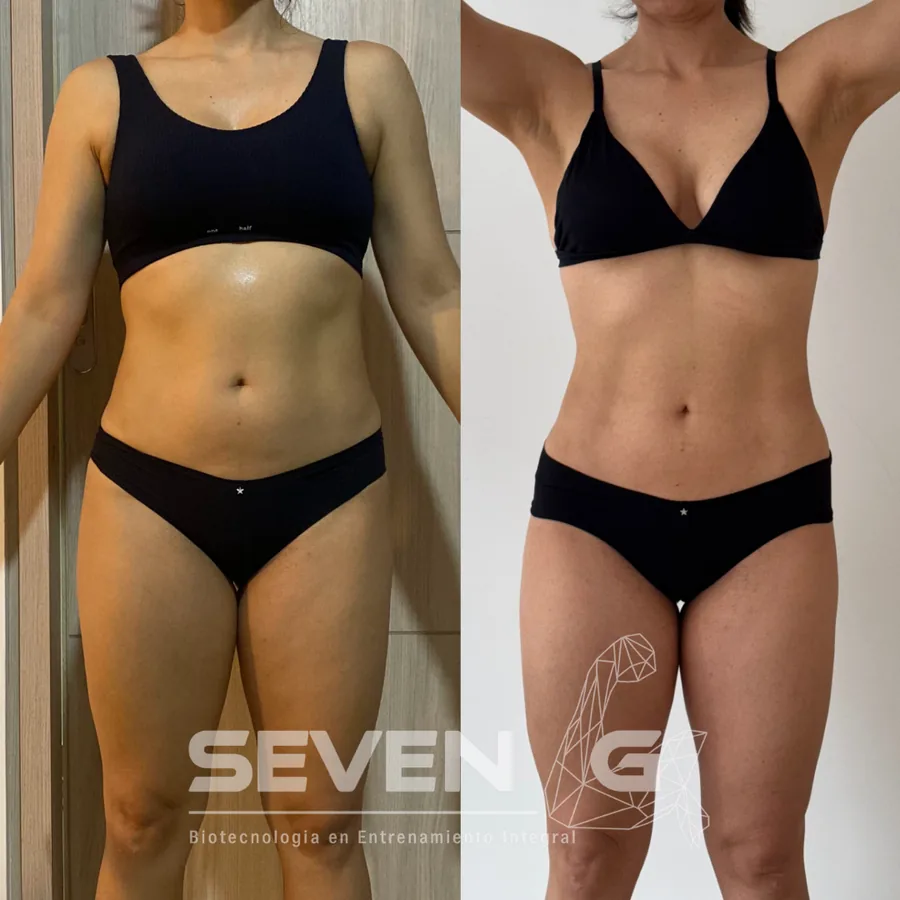 Antes y después de Ana Ruiz, 20 semanas