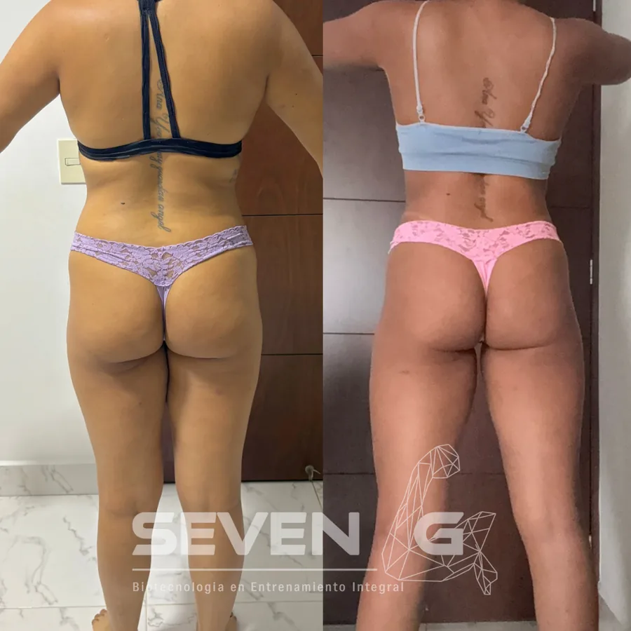 Antes y después de Valentina Rios, 24 semanas